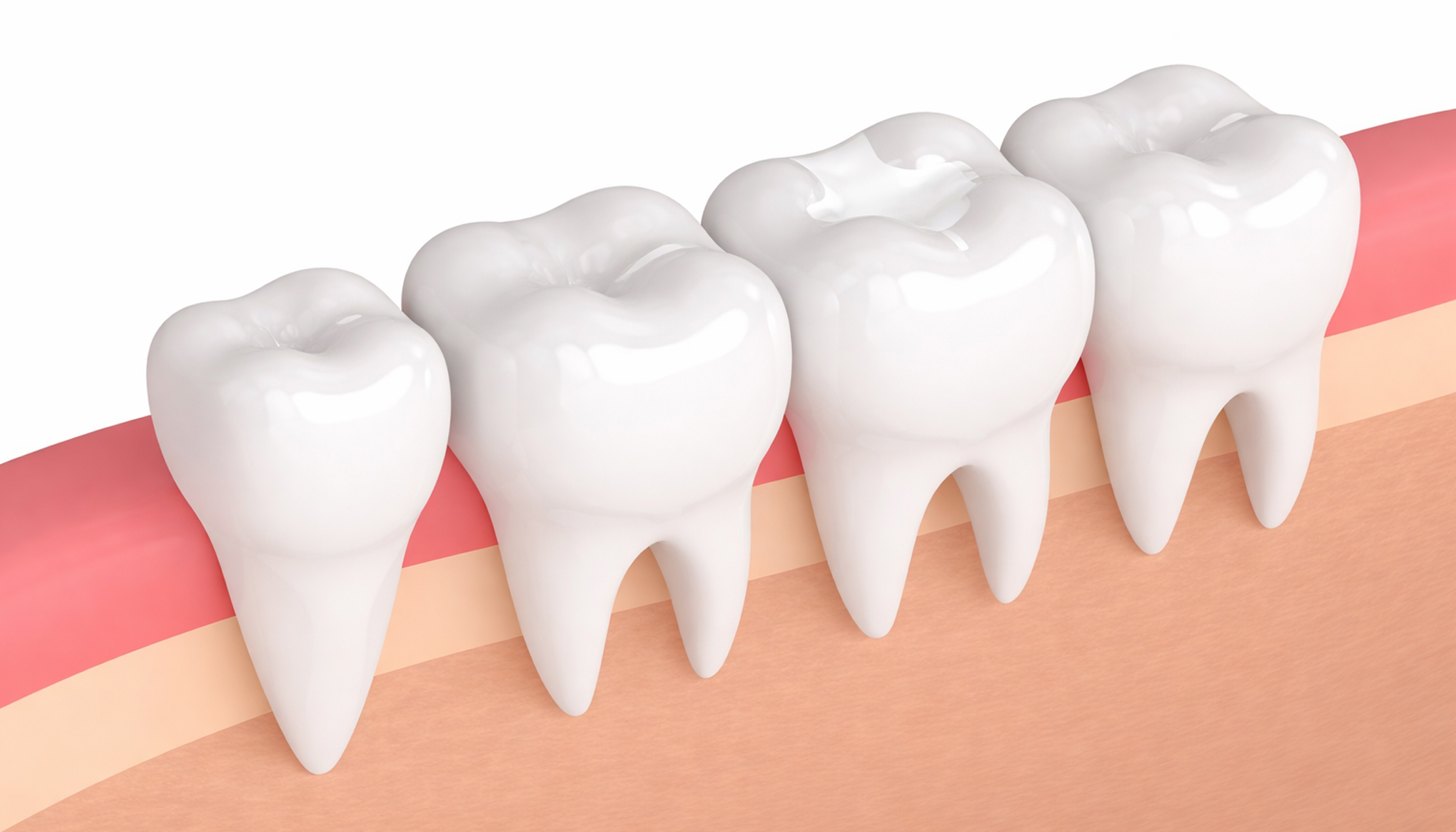 Restorative Dentistry 3 banner_3