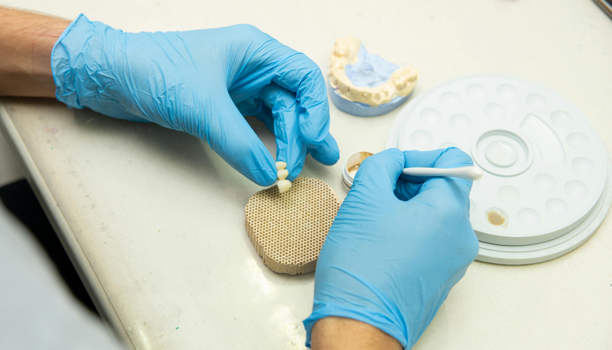 Restorative Dentistry 6 Dental Bridges