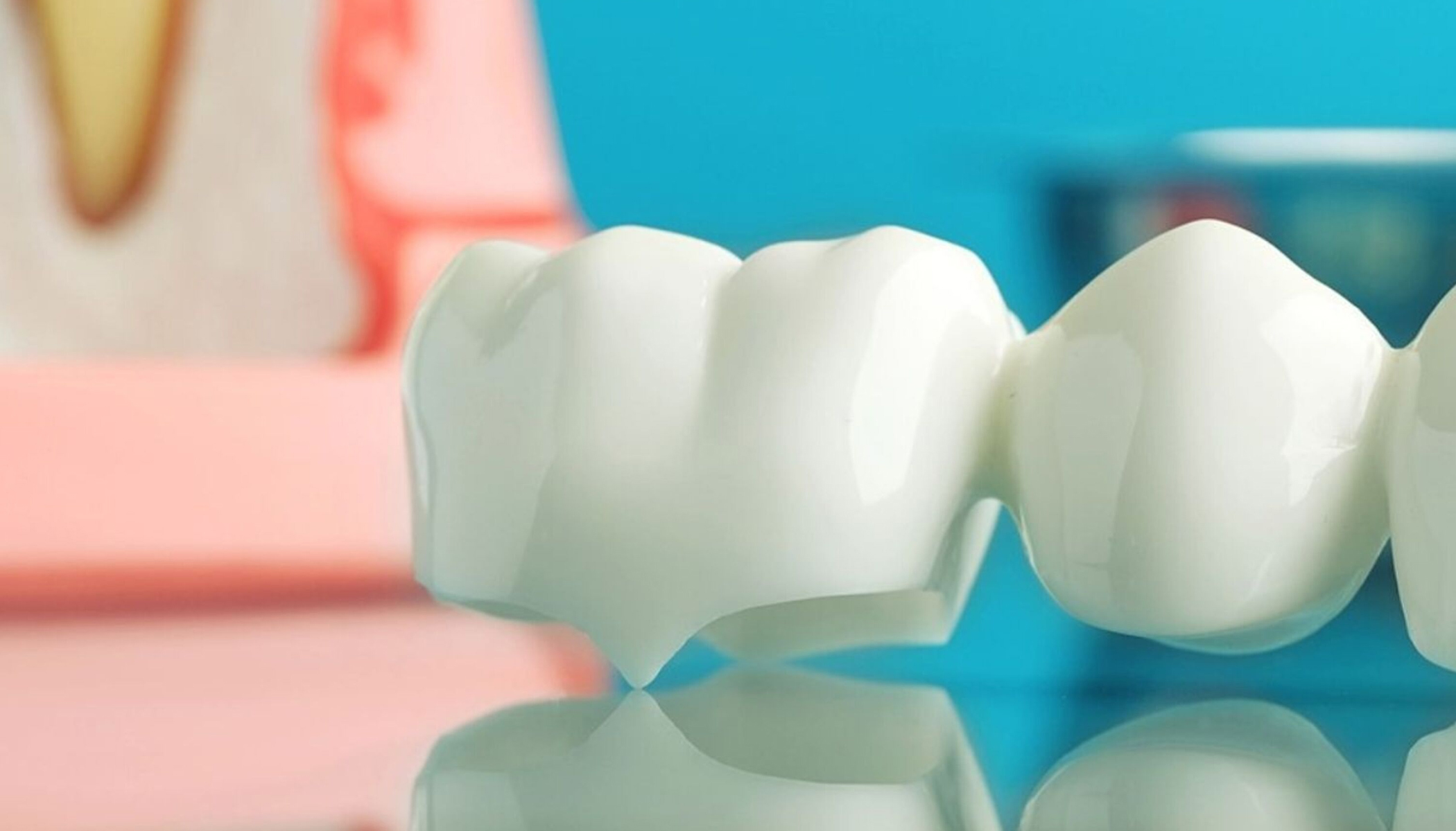 Restorative Dentistry 5 Dental Crowns