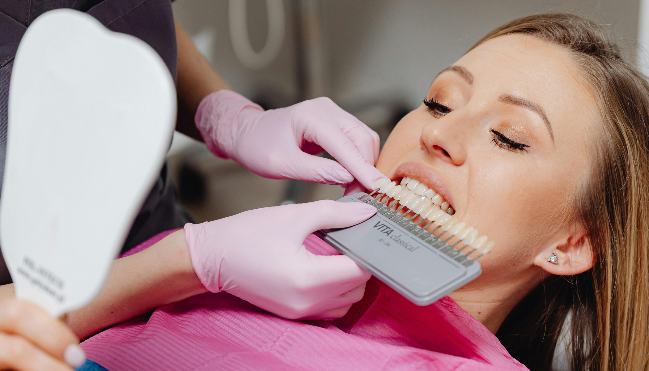 Cosmetic Dentistry 5 Direct Composite Veneers